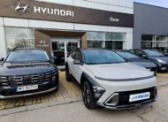 Hyundai Kona platinium luxury czarny dach